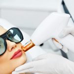 لیزر موهای زائد چیست - تمام نکاتی که باید درباره لیزر بدانید 10 هرآنچه که قبل از انجام لیزر موهای زائد باید بدانید