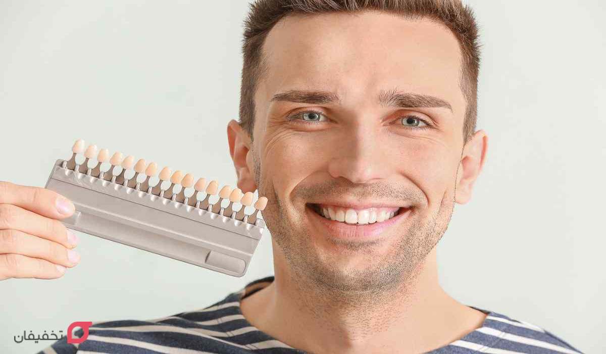 فرق کامپوزیت با کامپوزیت ونیر چیست؟