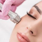 میکرودرم چیست؛ فواید میکرودرم برای پوست صورت و نحوه انجام 22 میکرودرم چیست و تاثیری روی پوست شما دارد؟