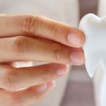 کامپوزیت ونیر چیست | بهترین مارک | تفاوت با کامپوزیت |عوارض 23 4 2