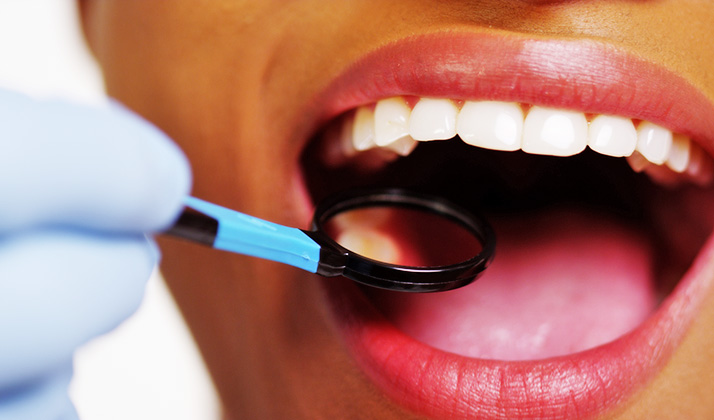 بلیچینگ دندان تا عمق مینای دندان نفوذ می‌کند و رسوبات نفوذ کرده را از بین می‌برد.