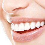 لمینت دندان چیست؛ آشنایی با انواع و مراحل انجام لمینت 28 با لمینت دندان میتوان به سادگی دندانهایی مرتب و یکدست داشت.