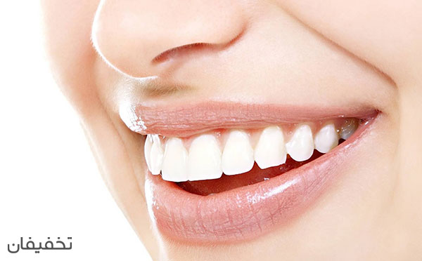 با لمینت دندان می‌توان به سادگی دندان‌هایی مرتب و یکدست داشت.