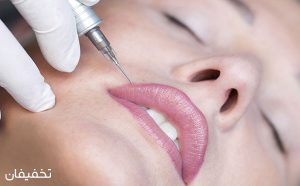 میکروپیگمنتیشن چیست | روش انجام + عکس | ماندگاری انواع آن