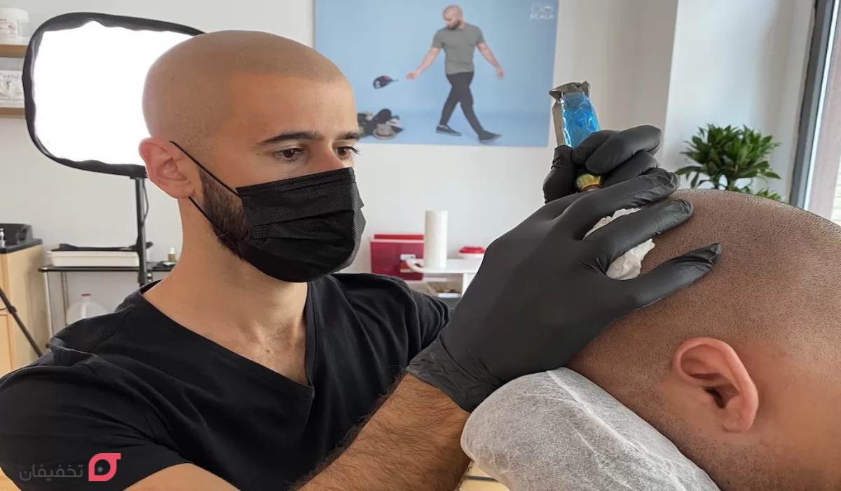 روش انجام میکروپیگمنتیشن 