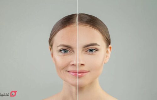هایفوتراپی چیست | نظرات در مورد عوارض و مزایا + مراحل انجام 28 هایفوتراپی چیست