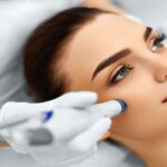 میکرونیدلینگ چیست |تعداد جلسات، عوارض، ماندگاری و انواع آن 26 میکرونیدلینگ چیست