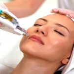 مزوتراپی چیست و چگونه انجام می شود؟ تعداد جلسات + عوارض 24 مزوتراپی