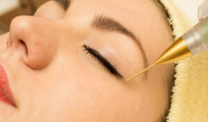 پلاسما جت چیست | روش کار | مزایا و عوارض | ماندگاری | عکس