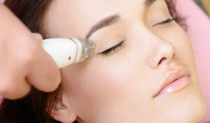 چند جلسه لیزر کافی است | فاصله و تعداد جلسات لیزر بدن و صورت