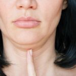 از بین بردن غبغب | سریعترین روش رفع غبغب در خانه 16 خانمی که خواستار از بین بردن غبغب یا رفع غبغب خود است