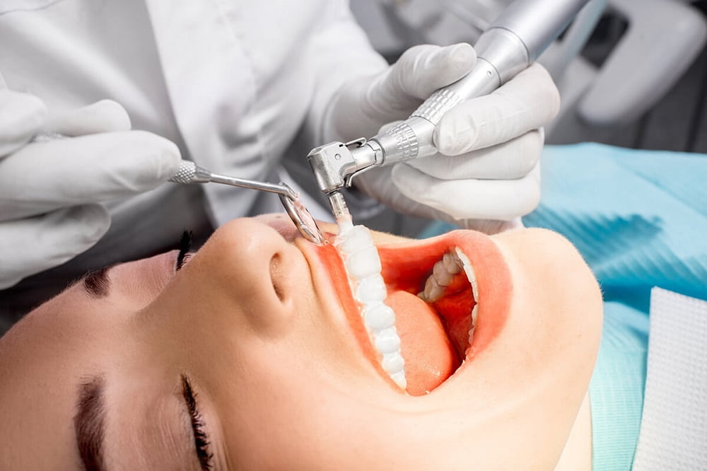 فلورایدتراپی دندان یا وارنیش دندان توسط یک دندانپزشک