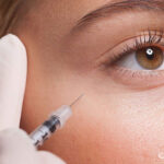 تزریق فیلر زیر چشم؛ عوارض و مزایا + عکس قبل و بعد تزریق 24 تزریق فیلر زیر چشم