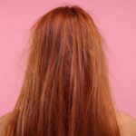 رفع وزی مو دائمی | 12 روش از بین بردن وزی مو سریع در خانه 25 رفع وزی مو