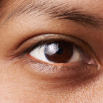 سیاهی زیر چشم در زنان و کودکان نشانه چیست؛ 8 درمان خانگی 21 سیاهی زیر چشم