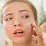 درمان خشکی پوست | 5 درمان خانگی سریع برای کل بدن و صورت 26 پوست 1