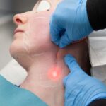 اندولیفت چیست؟ مراحل انجام، عوارض و زمان ماندگاری اندولیفت 27 اندولیفت صورت