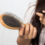 ریزش مو در زنان؛ علت ریزش سریع مو + بهترین درمان در خانه 28 hair fall 1