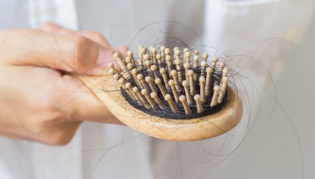 انواع ریزش مو در زنان