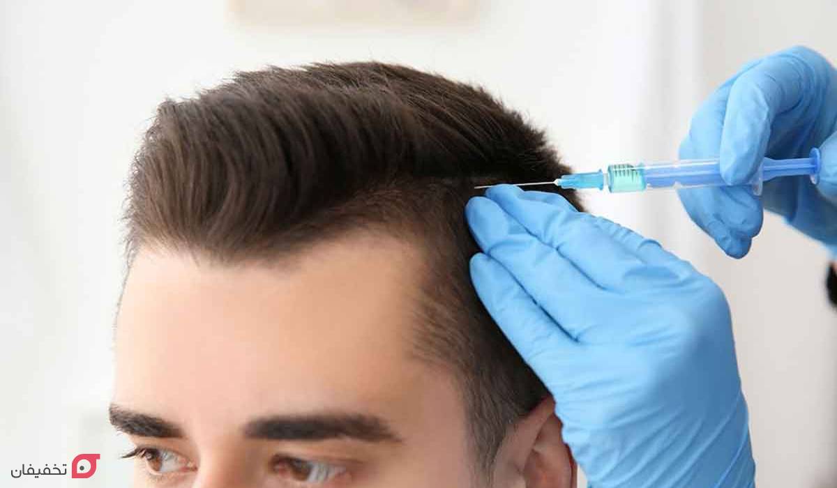 روش‌های انجام فیلر مو
