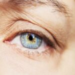 افتادگی پلک چیست | علت بروز + درمان سریع خانگی بدون جراحی 13 افتادگی پلک چیست
