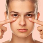 درمان گودی زیر چشم در آقایان و زنان | 10 درمان سریع خانگی 20 درمان گودی زیر چشم