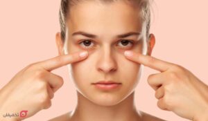 درمان گودی زیر چشم در آقایان و زنان | ۱۰ درمان سریع خانگی