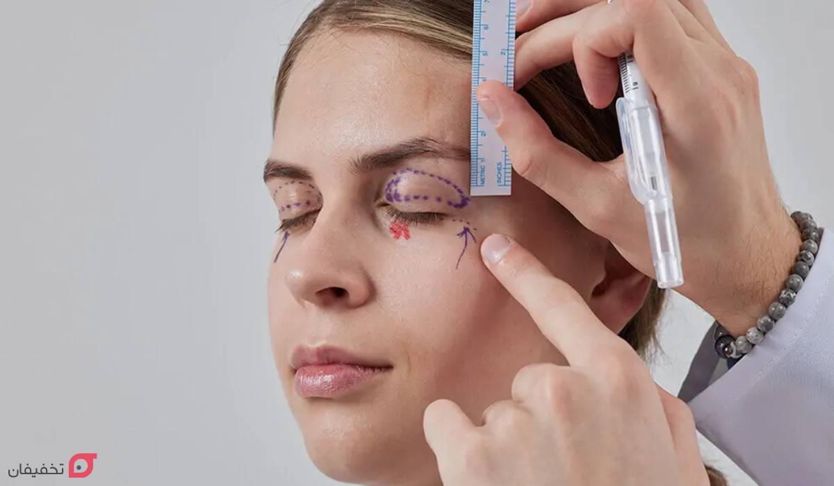 درمان گودی زیر چشم در آقایان و زنان | 10 درمان سریع خانگی 10 درمان گودی زیر چشم