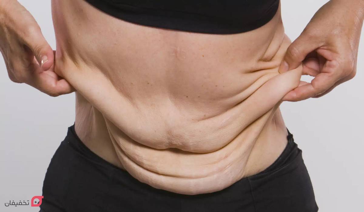 لیپوماتیک چیست | مزایا و عوارض | Bmi و وزن مناسب | ماندگاری 9 Bmi مناسب برای لیپوماتیک