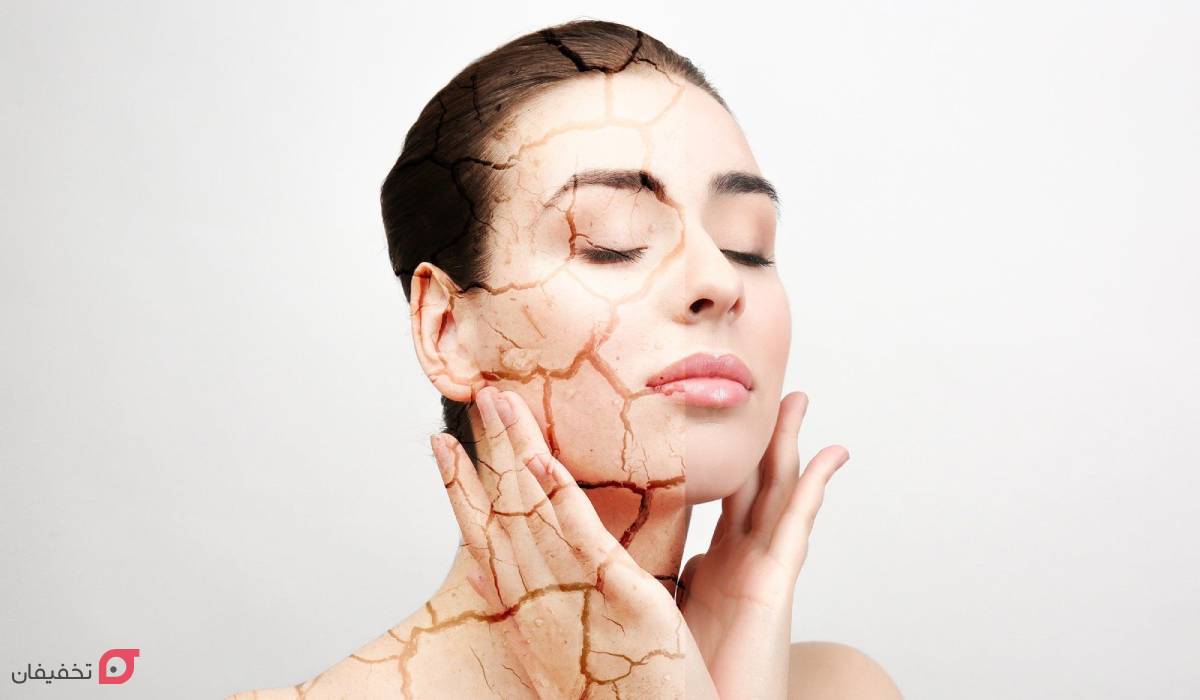 درمان خشکی پوست