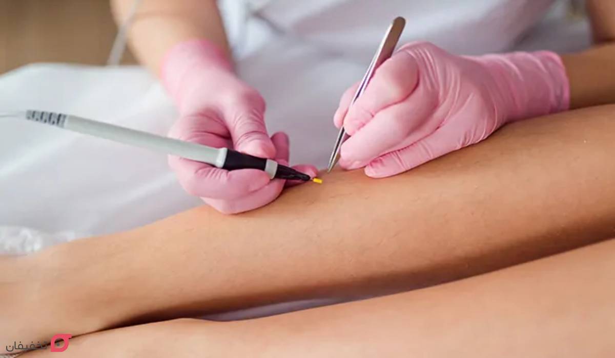 نکات قبل از لیزر موهای زائد | چند ساعت قبل لیزر شیو کنیم؟ 4 نکات قبل لیزر موهای زائد