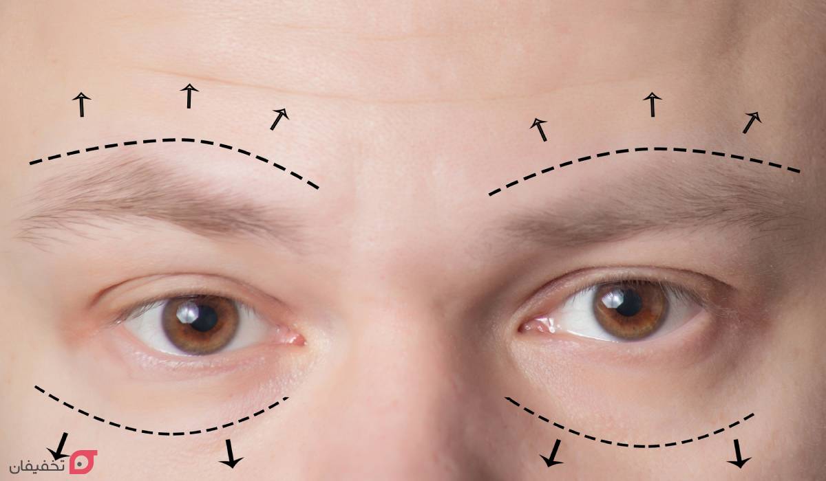 لیفت ابرو چیست | ماندگاری و انواع | عوارض و مزایا | عکس 10 لیفت ابرو در آرایشگاه