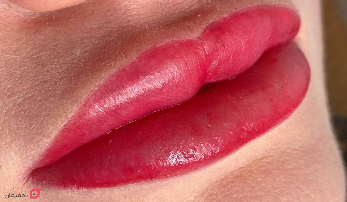 میکروپیگمنتیشن چیست | روش انجام + عکس | ماندگاری انواع آن 9 میکروپیگمنتیشن لب