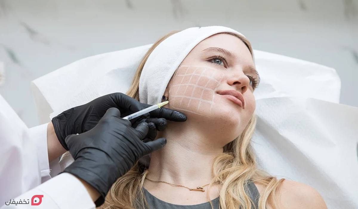 مزوتراپی صورت چیست | مدت اثر | فواید و عوارض | عکس نقاط تزریق 5 عکس قبل و بعد مزوتراپی صورت