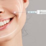 بوتاکس خط خنده چیست | نحوه تزریق و ماندگاری | عوارض + عکس 25 بوتاکس خط خنده