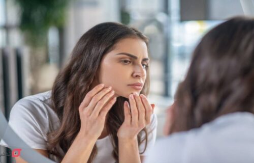 موهای زائد چانه