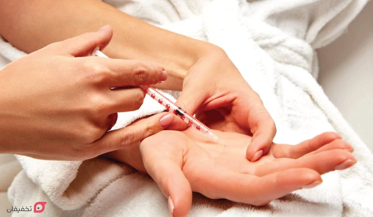 بوتاکس کف دست