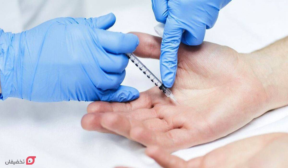 بوتاکس کف دست