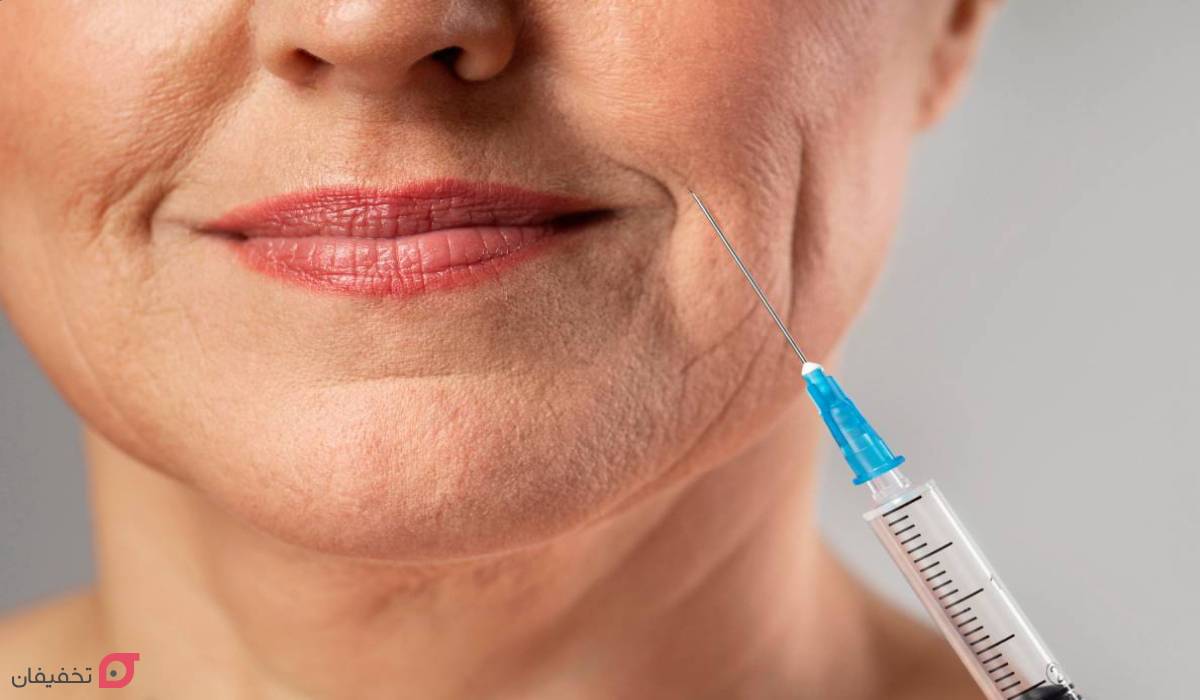 بوتاکس خط خنده چیست | نحوه تزریق و ماندگاری | عوارض + عکس 3 بوتاکس برای خط خنده