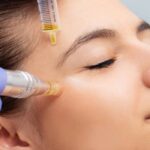 مزوتراپی زیر چشم | مزایا و عوارض | تعداد جلسات و ماندگاری 24 مزوتراپی زیر چشم