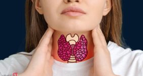 عوارض تیروئید کم کار