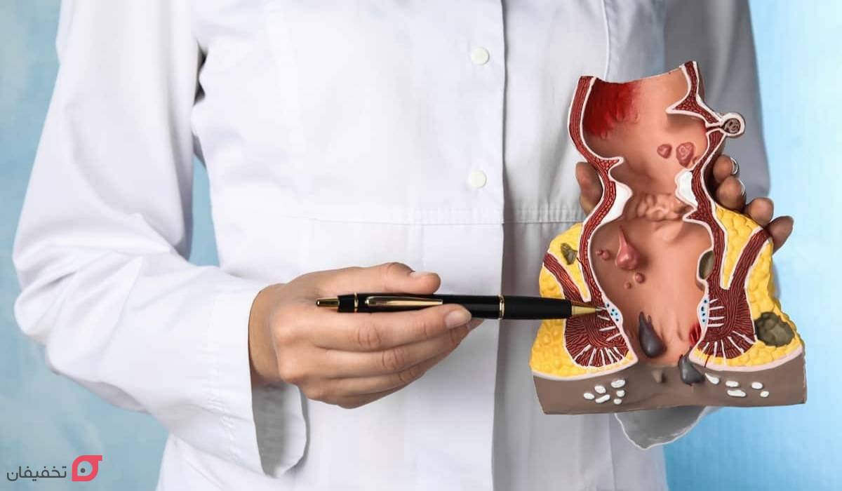 علت خارش مقعد