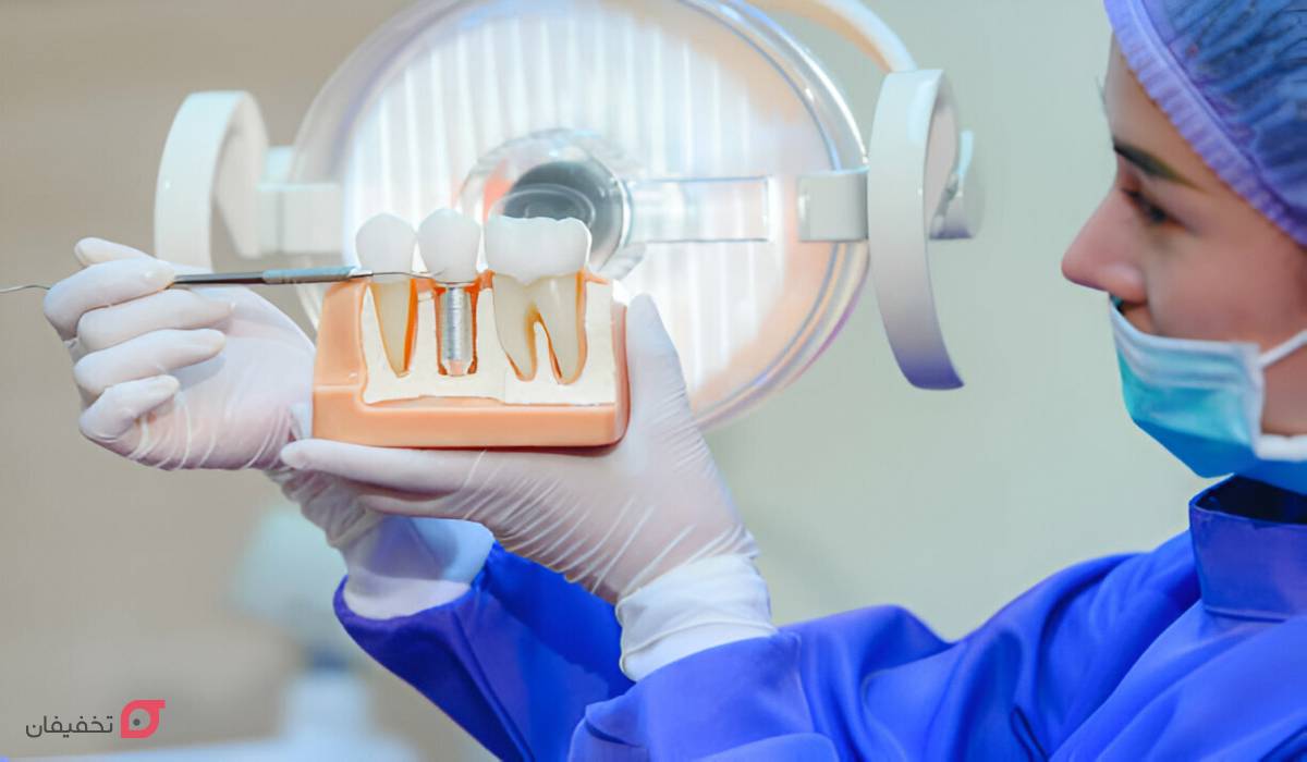 مراقبت های بعد از ایمپلنت