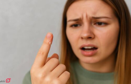 کمبود کدام ویتامین باعث پوسته شدن اطراف ناخن میشود