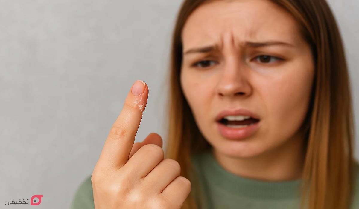 کمبود کدام ویتامین باعث پوسته شدن اطراف ناخن میشود