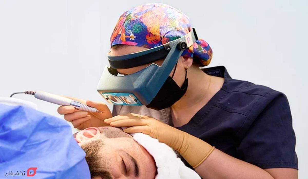 روش کاشت مو بدون بانک مو