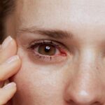 علت قرمزی چشم در کودکان و بزرگسالان | 5 درمان فوری خانگی 22 علت قرمزی چشم