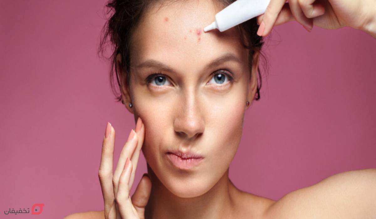 علت جوش پیشانی در زنان