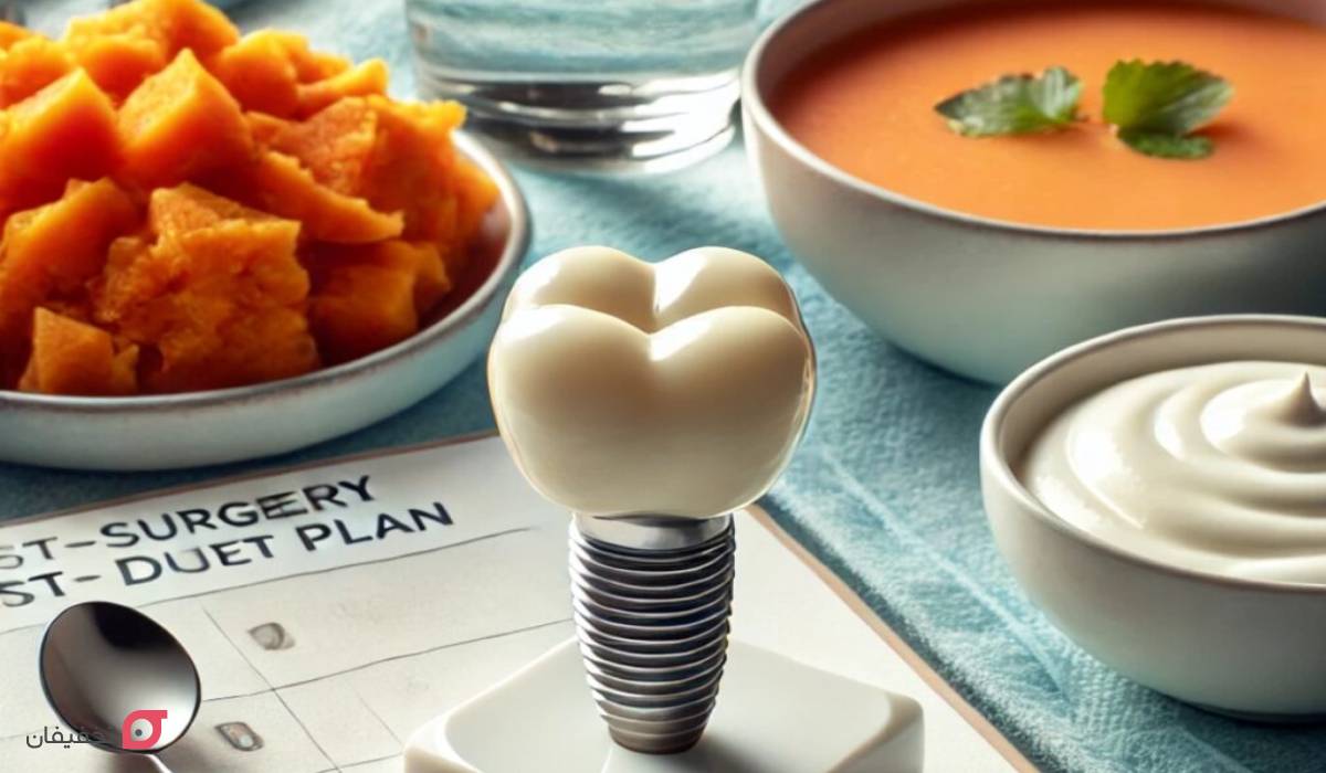 بعد از ایمپلنت چی بخوریم