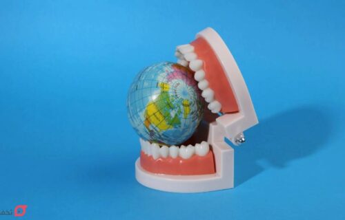 بهترین کامپوزیت دندان برای کدام کشور است